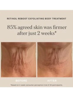 Alpha-H Retinol Reboot Exfoliating Body Treatment 8 Alpha-H Retinol Reboot Exfoliating Body Treatment -Jane Iredale Cosmetics Store Alpha HRetinolRebootExfoliatingBodyTreatment 2