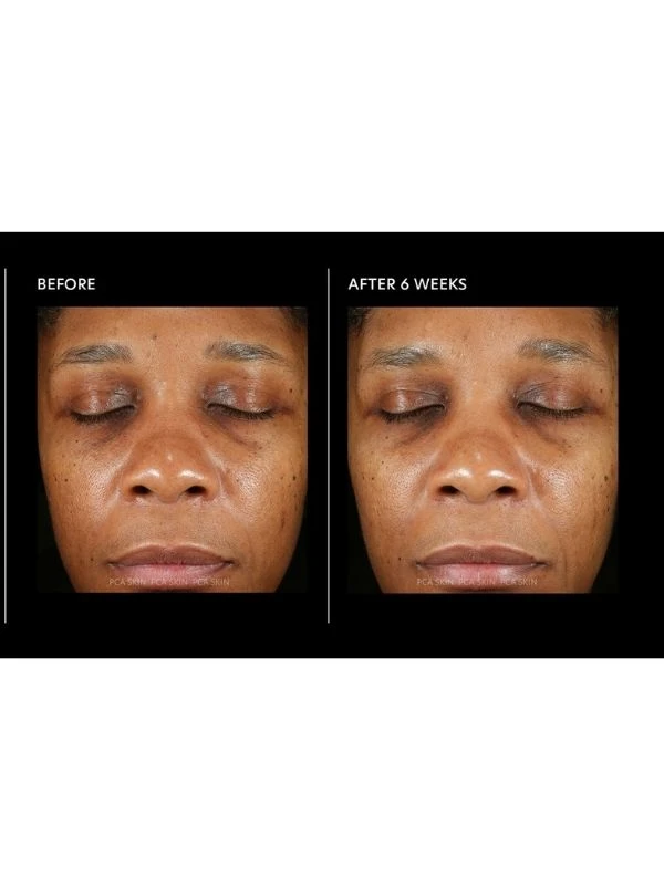 PCA Skin Hyaluronic Acid Overnight Mask 5 PCA Skin Hyaluronic Acid Overnight Mask - Image 3