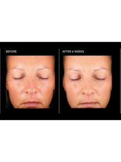 PCA Skin Hyaluronic Acid Overnight Mask 6 PCA Skin Hyaluronic Acid Overnight Mask -Jane Iredale Cosmetics Store PCASkinHyaluronicAcidOvernightMaskBeforeandAfter2