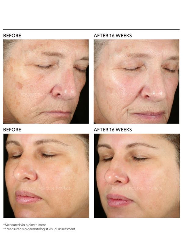 PCA Skin Pigment Gel Pro 4 PCA Skin Pigment Gel Pro - Image 2