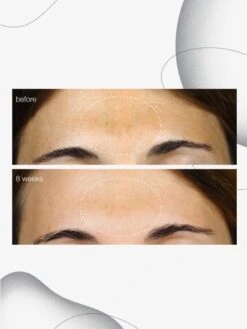 Jane Iredale Cosmetics Store 33 Jane Iredale Cosmetics Store -Jane Iredale Cosmetics Store PowerBrightDarkSpotSerumBeforeandAfter