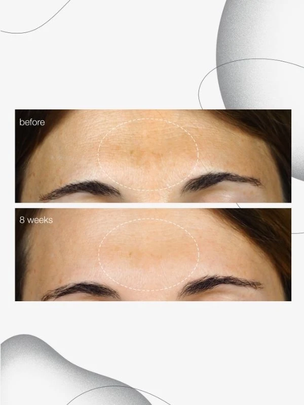 Dermalogica PowerBright Dark Spot Serum 4 Dermalogica PowerBright Dark Spot Serum - Image 2