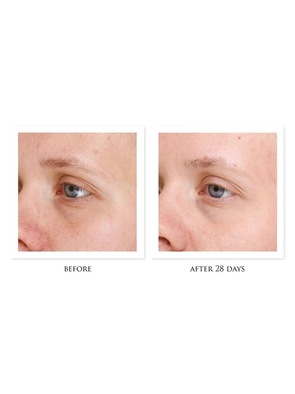 CosMedix Refine 4 CosMedix Refine - Image 2