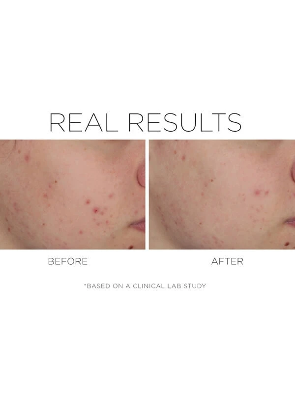 CosMedix Shineless 4 CosMedix Shineless - Image 2