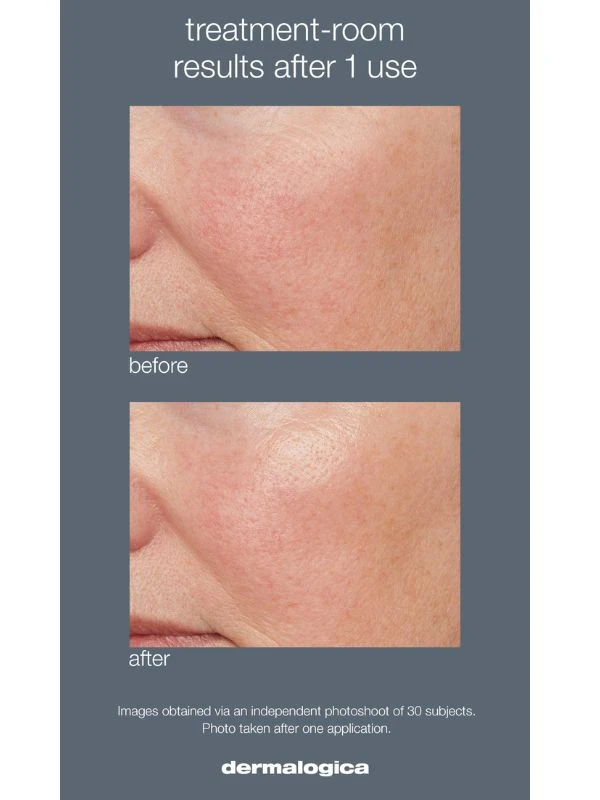 Dermalogica Liquid Peelfoliant 5 Dermalogica Liquid Peelfoliant - Image 3