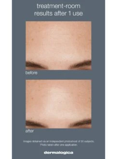 Dermalogica Liquid Peelfoliant 11 Dermalogica Liquid Peelfoliant -Jane Iredale Cosmetics Store liquidpeelfoliant 3