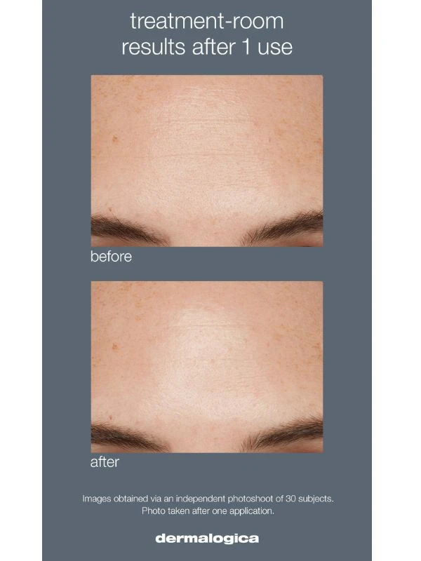 Dermalogica Liquid Peelfoliant 6 Dermalogica Liquid Peelfoliant - Image 4