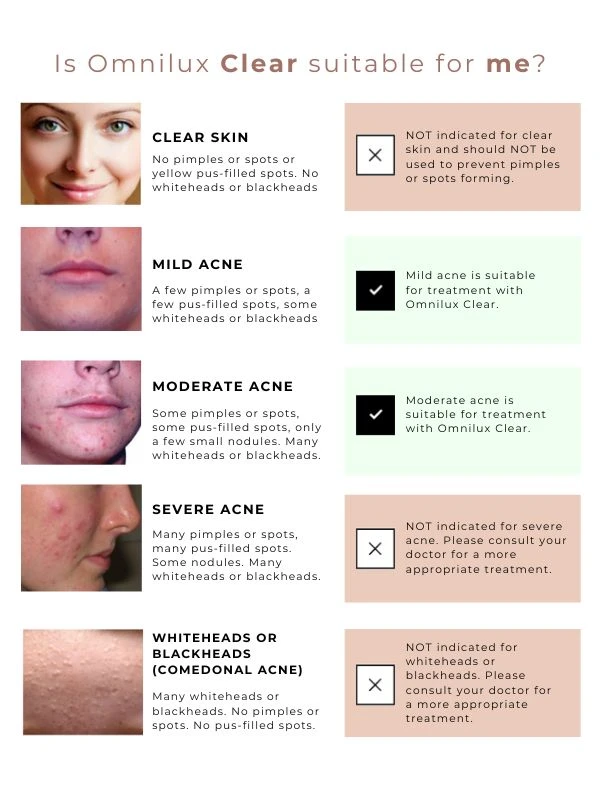 Omnilux Clear 5 Omnilux Clear - Image 3